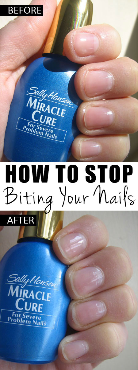 How to Stop Biting Your Nails Quick and Easy Solution That Really Works! 